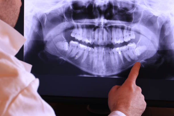 Best Emergency Tooth Extraction in Farmersville, TX