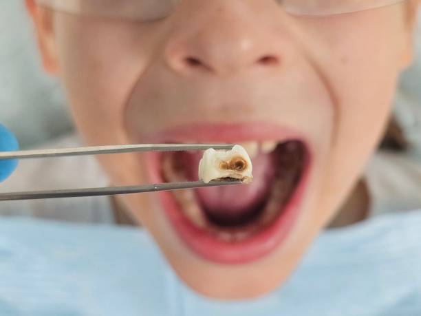 Best Pediatric Emergency Dentist in Farmersville, TX